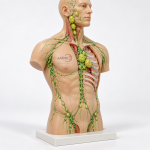 Lymphoma Model